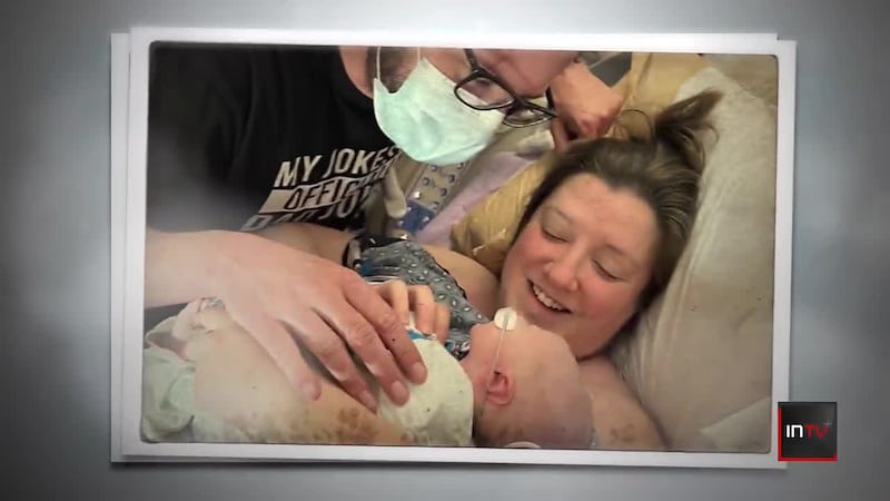 Innovative heart surgery helps to save life of newborn baby